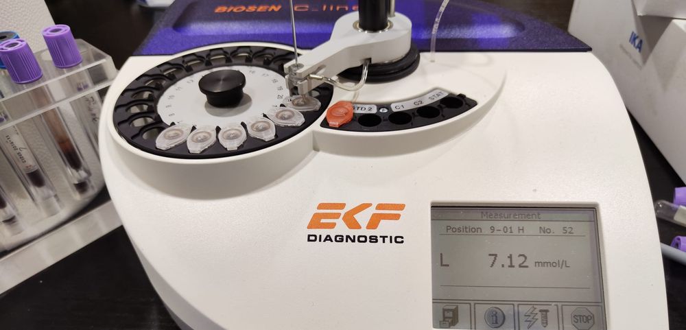 lactate scout analisis acido lactico sangre rendimiento fisico EKF biosen lactato glucosa